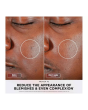 Shark FW312UKPK CryoGlow Under-Eye Cooling + LED Anti-Ageing & Blemish Repair Mask - Spa Pink | Skin Care | Health & Beauty | Home & Outdoor | Catalogue | Euronics Site